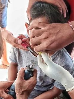 Kail Pancing Tersangkut di Bibir Anak 13 Tahun di Katingan, Petugas Damkar Lakukan Pelepasan