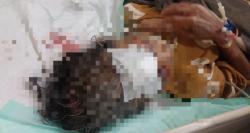 Tragis !! Seorang Nenek Alami Luka Robek di Kepala Usai Dianiaya Tetangganya