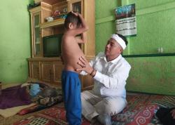 Kades Cibadak Turun Tangan, Bantu Anak 7 Tahun Derita Pembengkakan Perut Sejak 2021