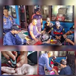 IRT Minta Bantuan Damkar Lepaskan Cincin Emas yang Melekat di Jari Tangan yang Telah Membengkak