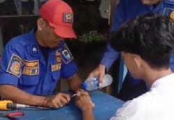 Dramatis! Petugas Damkar Lebak Evakuasi Cincin Nyangkut di Jari Remaja di Bayah