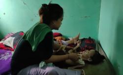 Miris! Bocah 10 Tahun di Pandeglang Derita Lumpuh Otak dan Gizi Buruk, Berat Badan Hanya 7 Kg