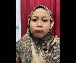 Viral ! Pengantin Bibir Bengkak Sebelum Nikah, Netizen: Mungkin Doa Mantan Kuat Banget