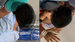 Sadis! Dua Warga Kuta Mandalika Dikeroyok Brutal Usai Melerai Tawuran di Bar