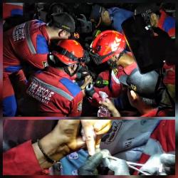 Bocah 3 Tahun Menangis Histeris Saat Petugas Damkar Evakuasi Tutup Parpum Tersangkut di Jarinya