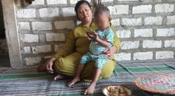 Kisah Nazril Balita Tanpa Anus di Bojonegoro, Hidup dengan Kateter 2 Tahun Menanti Panggilan Operasi