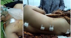 Diduga Tak Direstui, Pria di Musi Rawas Ditusuk Berkali-kali oleh Ayah Calon Mertua