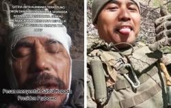 Eks Marinir TNI AL Satria Kumbara Terluka Parah Diserang Drone dan Mortir Ukraina