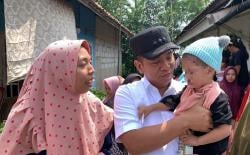 Air Mata Ibu Balita Pecah, Bupati Karawang Siapkan Operasi Gratis untuk Rian yang Terlahir Sumbing