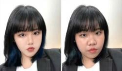Viral! Klinik Kecantikan Diserbu Pasien Remaja dan Usia Matang Ingin Wajah Mirip Filter Medsos