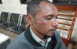 Kepala Desa di Insana TTU Dipolisikan Gegara Keroyok Warga hingga Terluka