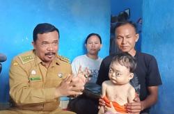 Anak Penderita Penyakit Serius di Indramayu akan Kembali Dirujuk ke Rumah Sakit