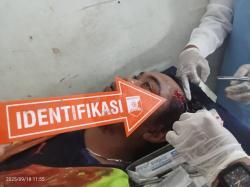 Seorang Pekerja Jembatan di Yahukimo Dianiaya OTK