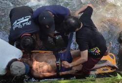 Purawirawan Polisi Terjatuh dari Atap Saat Perbaiki Genting, Alami Patah Tulang di Tangan dan Kaki