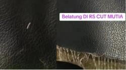 Viral! Ranjang di Ruang IGD RSUD Cut Meutia Aceh Utara Penuh Belatung, RS Alasan Ruang Penuh