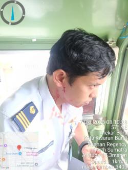 Kereta di Asahan Diserang Batu, Asisten Masinis Berdarah!