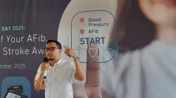 Cegah Stroke Mematikan Perlu Rajin Pantau AFib, Apa Itu?