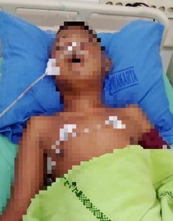 Miris, Bocah Disabilitas yang Kritis Usai Dihakimi Warga di Karawang Malah Dilaporkan ke Polisi