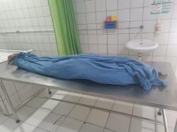 Setelah Dirawat Intensif, Anak Disabilitas Korban Pengeroyokan di Karawang Meninggal Dunia