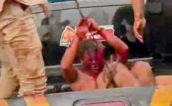 Ngeri! ODGJ Mengamuk, 13 Warga Alami Luka Bacok Dilarikan ke Rumah Sakit