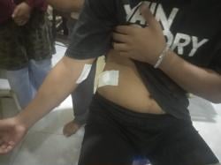 Pemuda di Tempilang Ditusuk Ayah Tiri Pakai Pisau Dapur