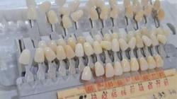 Profesi Teknisi Gigi Langka Tapi Menjanjikan, Peluang Karier Terbuka Lebar di Indonesia