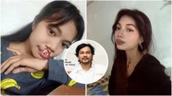 Operasi Gratis dari Dokter Tompi, Rista Buktikan Viral Bisa Bikin Hidup Lebih Hidup