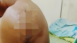 Ngeri! Warga Tarakan Ditebas Parang, Pelaku Pengeroyokan Belum Ditangkap