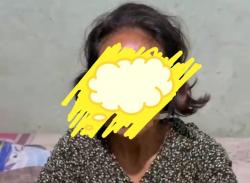 Derita Tumor Ganas, Warga Mancak Kabupaten Serang Kesulitan Lanjutkan Pengobatan