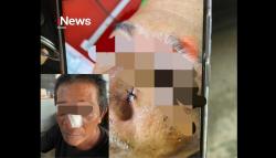Pria Asal Barru Diduga Dianiaya di Parepare, Hidung Korban Robek Usai Dipukul