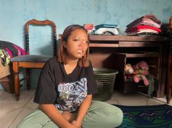 Tak Punya Biaya Untuk Berobat, Kondisi Balita Korban Kekerasan di Karawang Kian Memburuk