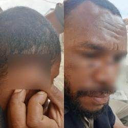 Pengeroyokan di Sentani, Diduga Dipicu Miras