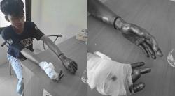 Ngeri! Pengendara RX King Diserang dan Dibacok OTK di Pangandaran