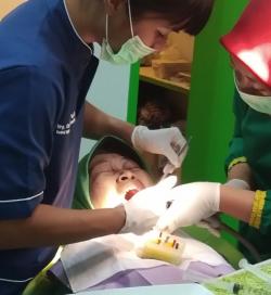 Gigi Sensitif Jangan Dianggap Sepele, Bisa Jadi Tanda Gangguan Lebih Dalam