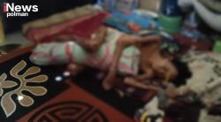 Memilukan! Remaja 20 Tahun Ini Hanya Bisa Terbaring, Kulit Mengelupas Seluruh Tubuh