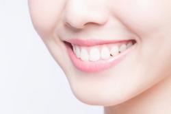 Riset: 27,6 Persen Perempuan Indonesia Tidak Percaya Diri dengan Kondisi Gigi