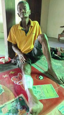 Bahaya Kabel Menjuntai, Pedagang Pasutri Terluka di Dekat Rumdin Bupati Sragen