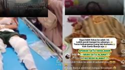 Tragis, Santri Diduga Jadi Korban Bullying Hingga Mengalami Luka Bakar Berat