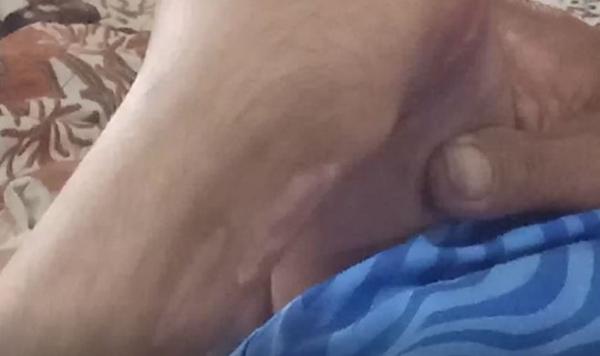 Bekas luka bakar di badan Rizky, Selasa (21/1/2020) (Foto: iNews/Saufat Endrawan)