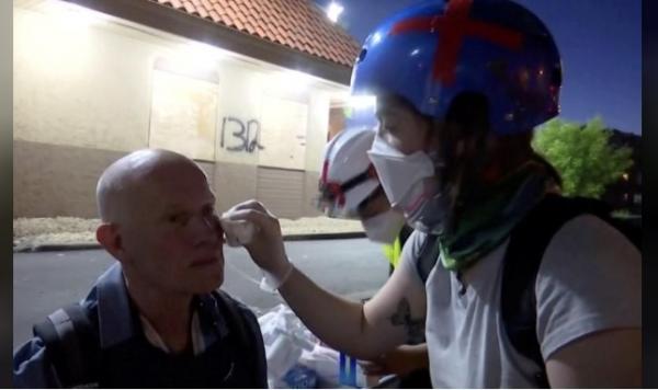 Seorang jurnalis mendapat perawatan usai jadi sasaran tindakan represif aparat saat meliput demonstrasi antirasial di Minneapolis, Ameria Serikat