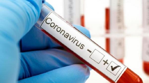 Pakar UGM Sebut Pandemi Covid-19 Berakhir Februari 2021, Estimasi Positif 227.000 Kasus<