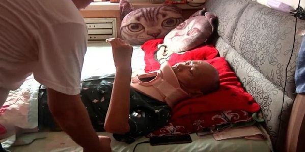 Gao Fenghua mengalami cedera leher usai kejatuhan kucing di Harbin, China. (foto: The Sun)