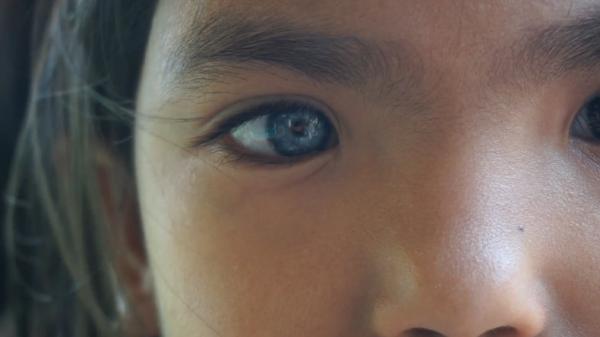 Matabiru Warga Tanah Datar Sumbar mempunyai bola mata berwarna biru (Agung Sulistyo/iNews)