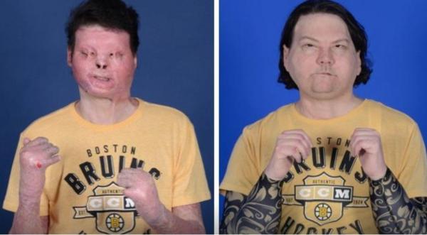 000 Cangkok Wajah Tangan Reu