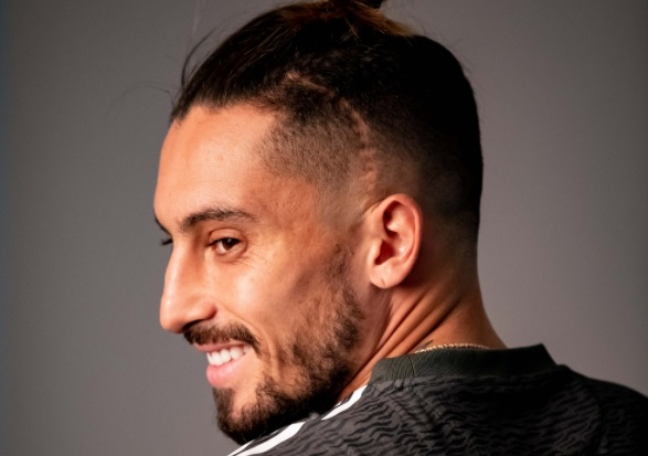 Alex Telles Bek Manchester United (MU) Alex Telles punya codet di kepala. Namun dia justru bangga dengan bekas luka tersebut. (Foto: Manchester United)