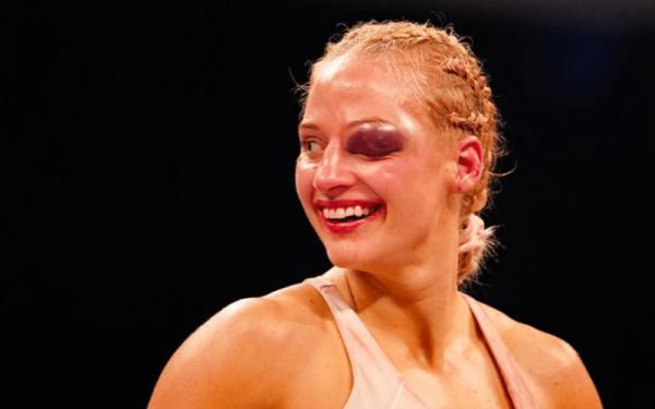 Ebanie Bridges Wajah petinju cantik Ebanie Bridges bonyok dihajar lawannya Shannon Courtenay, Minggu (11/4/2021). Matanya memar sangat besar. (Foto: New York Fights)