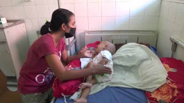 Seorang ibu menjaga bayinya yang menderita hidrosefalus di RSUD URM Kota Waingapu. (Foto: iNews.id/Dionisius Umbu Ana Lodu)