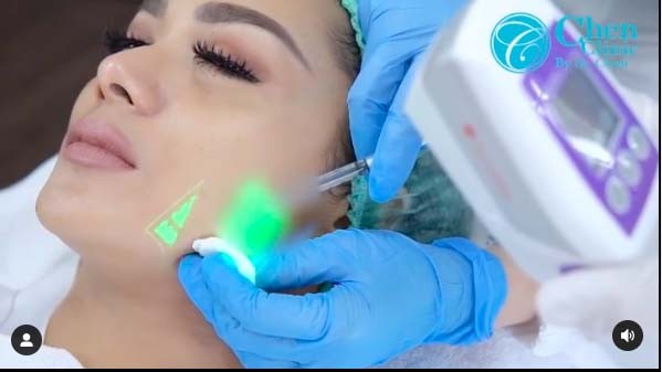 Perawatan DNA Salmon Jadi Tren, Waspada Ini Efek Sampingnya