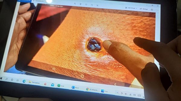  Virus antraks mewabah di Kabupaten Gunungkidul, Daerah Istimewa Yogyakarta (DIY). (Foto Antara).