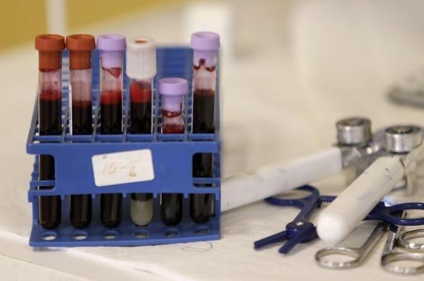Hoax Donor Darah dari Orang yang Sudah Divaksin Bahaya, Ini Penjelasan Jubir Covid-19